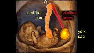 9 weeks of pregnancy gestational sac and embryo  3D scan [upl. by Henryson808]