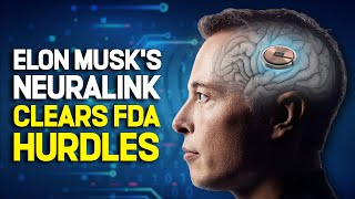 Elon Musks Neuralink The Future of BrainComputer Interface [upl. by Key]