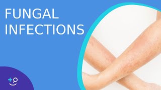 Fungal Infections  Causes Prevention and Cure [upl. by Eniagrom]