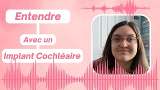 Entendre avec un implant cochléaire [upl. by Atterol]