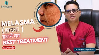 Best Treatment for Melasma  Laser Treatment for Melasma in Delhi  SkinQure  Dr Jangid [upl. by Aristotle]