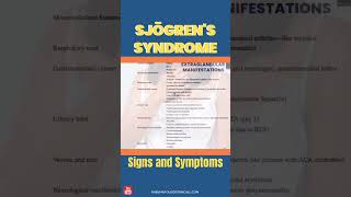 Sjogrens Syndrome Signs and Symptoms sjogrens sjogren [upl. by Durham]