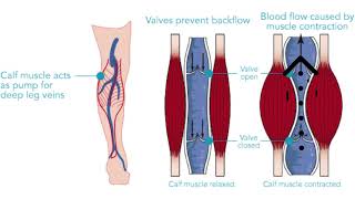 Soleus Muscle  Trigger Point Anatomy  Referred Pain [upl. by Nina863]