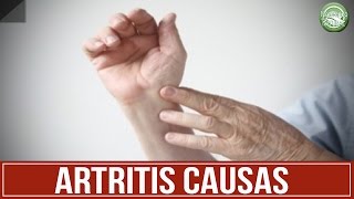 ARTRITIS Sintomas y Causas  Artritis Reumatoide [upl. by Amelina]