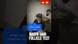 Hair Follicle test ni Cong PULONG SUMUNOD KAYA news everyone followers fyp fyp ctto [upl. by Oremoh]