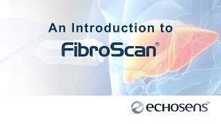 A Patients Introduction to FibroScan [upl. by Luapsemaj823]