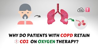 Oxygen Induced CO2 Narcosis in COPD Patients [upl. by Innoj]