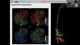 5 Cerebelo cognitivo [upl. by Nonnair875]