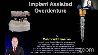 Implant Assisted Overdenture [upl. by Lester]