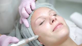 Reviderm Micro Needling  Sugaringqueen Erfurt [upl. by Davena]