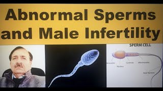 Abnormal Sperms and Male Infertility  Lectures by Dr Alamzeb [upl. by Nwahs315]