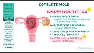 OSMOSIS Ectopic pregnancy Gestational Hypertension placental abruptions Troph disease 🔥🔥 [upl. by Aliak962]