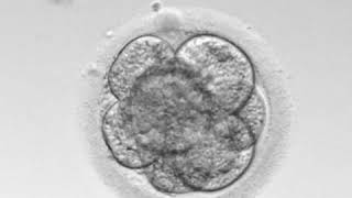 Timelapse Geri  vývoj embryaTime Lapse embryo monitoring [upl. by Lehcsreh]