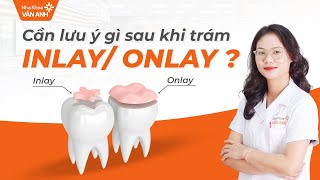 Cần lưu ý gì sau khi trám Inlay Onlay [upl. by Nasar]