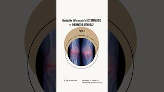 Osteoarthritis VS Rheumatoid Arthritis osteoarthritis rheumatoidarthritis physionearme [upl. by Emmet]