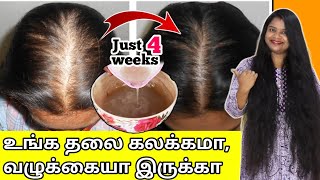 🔥JUST 4 WEEKS போதும்😱 வழுக்கையா தெரியுற உங்க தலையில் நெருக்கமா முடி முளைக்கும்  baldness tips [upl. by Ise]