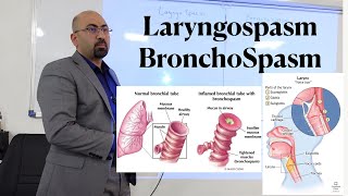 lec LaryngoSpasm amp Bronchospasm [upl. by Enomas440]