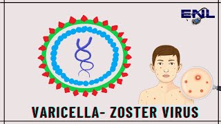 Varicella Zoster Virus  Microbiology  Explanation in Hindi [upl. by Anirbac91]