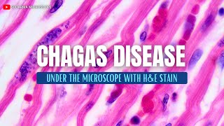 Chagas disease under the microscope with Haematoxylin and Eosin HampE stain [upl. by Nnairret468]