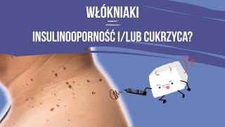 Zmiany skórne które mogą oznaczać insulinooporność Jak je rozpoznać i co warto wiedzieć [upl. by Sillek772]