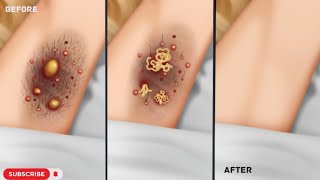 ASMR Removal Hair  Armpit Treatment Injured Animation  Underarm ASMR [upl. by Rutra716]