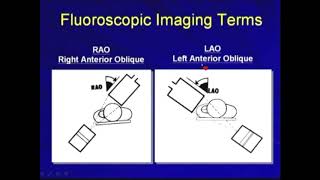 91 Pacemaker Implantation Fluoroscopic Imaging Hong Kong University [upl. by Slorac]