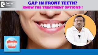 GAP in Front Teeth DIASTEMA Closure  4 Methods to Fix Teeth GapDrNirmal Raj A P Doctors Circle [upl. by Aciras]