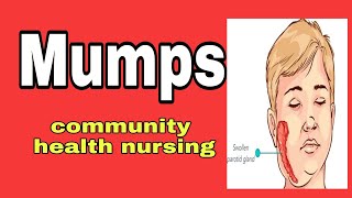 mumps in hindi community health nursing community medicine [upl. by Mat921]