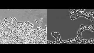 Pseudomonas aeruginosa biofilm expansion via twitching motility [upl. by Andreas380]