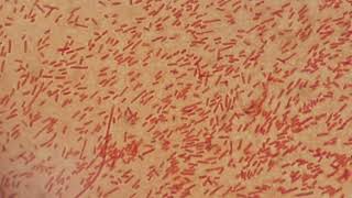 Gram negative bacteria [upl. by Tatia432]