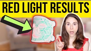 DO LED LIGHT MASKS REALLY WORK  Dermatologist reviews Omnilux [upl. by Aner]