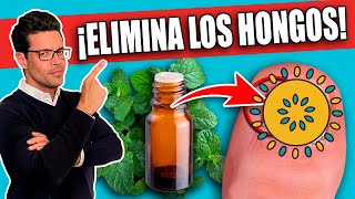 ¡Elimina HONGOS en las UÑAS en 1 DÍA⁉️  REMEDIOS NATURALES para HONGOS en las UÑAS [upl. by Rumery]