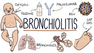 Understanding Bronchiolitis [upl. by Iroj696]