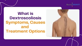 Understanding Dextroscoliosis Symptoms Causes and Treatment Options Dextroscoliosis scoliosis [upl. by Asyla]