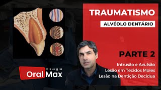 Traumatismo Alvéolo Dentário Parte 2 [upl. by Nairbal105]