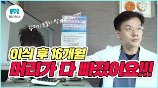 모발이식 16개월 후 갑자기 머리가 다 빠졌어요 [upl. by Iiette]