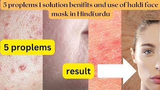 Shocking Benefits of  Haldi face mask Korean skincare [upl. by Purcell630]