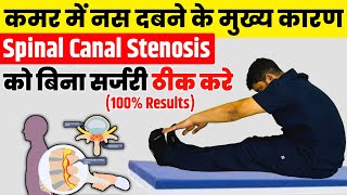 Spinal Canal Stenosis को बिना सर्ज़री ठीक करे  Treatment Of Lumbar Canal Stenosis Without Surgery [upl. by Dyun]