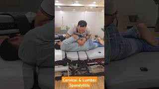 Cervical and Lumbar Spondylitis Treatment in India DrMushtaque 🇮🇳 chiropractor Migren sciatica [upl. by Eibbil]