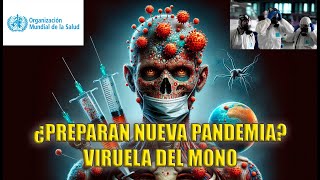 ¿NUEVA PANDEMIA  VIRUELA del MONO by ÁFRICA [upl. by Gerc]