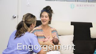 Breast Engorgement ManagementPart 1Causes ampSymptoms Engorged Milk good or bad for babies [upl. by Botsford559]