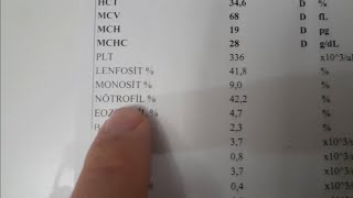 COMPLETE BLOOD COUNT CBC TEST INTERPRETATION [upl. by Scevour]