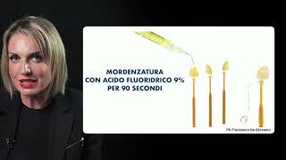 Finalizzazione del caso estetico cementazione adesiva per faccette dentali [upl. by Faucher]