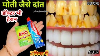 एक बार में दांत का कीड़ा और दर्द बाहर निकालने का बेहतरीन उपाय  How To Get Rid Of Tooth Cavity [upl. by Christina720]