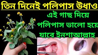 এই গাছ চিনে রাখুন নাকের পলিপাস ভালো করে দিচ্ছে। [upl. by Hun]