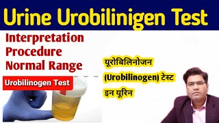 Urine Urobilinogen Test in Hindi   Ehrlichs aldehyde test [upl. by Eimmit]