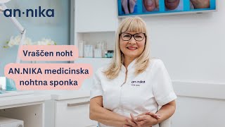 Vraščanje nohta  ANNIKA medicinska nohtna sponka [upl. by Zsuedat262]