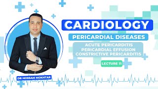 Cardiology ll Pericardial Diseases ll  Acute pericarditis amp Pericardial effusion amp CP [upl. by Attenyl929]