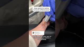 How painful is tattoo removal at Removery🧐 [upl. by Sheri633]