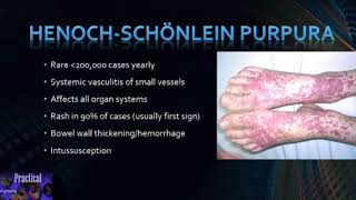 HenochSchönlein Purpura [upl. by Imaon]